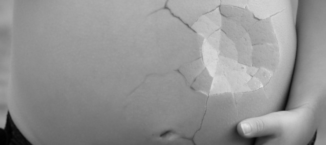 Condena por negligencia en un parto Condena por negligencia en un parto
